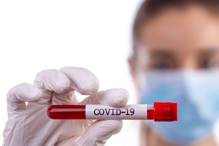 Анализ на антитела к COVID-19